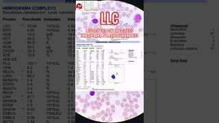 LLC VS LMC #hematologia #medicina #laboratorio