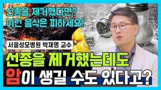 [닥터소확행 27화] 암의 전 단계 선종! 제거해도 암이 생기는 이유는? 선종이 발견되었다면 반드시 확인하세요!