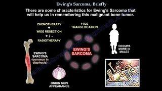 Ewing's Sarcoma, Briefly - Everything You Need To Know - Dr. Nabil Ebraheim