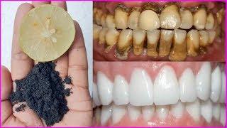 Magical Teeth Whitening Remedy, Get whiten Teeth at home in 2 minutes