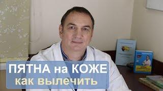 Пятна на коже: розовые или белые - как вылечить.