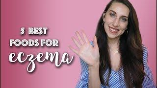 5 Best Foods for Eczema Healing | Michelle Mills