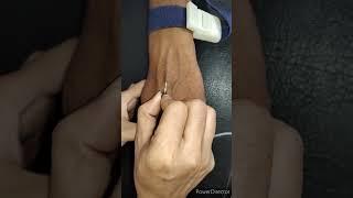 How to place scalp vein set to give IV fluids | complete process step by step #medicalprocedures