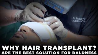 Why Hair Transplants are the Best Solution for Baldness | Trichometric Sapphire FUE | Cara Clinic