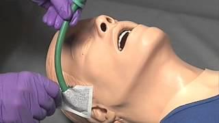 EMS Skills - Nasopharyngeal Airway Insertion