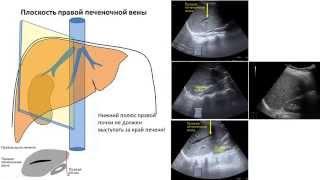 Плоскости ультразвукового  сканирования печени