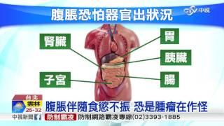 "腹脹"要注意! 當心是器官重症徵兆│中視新聞 20160829