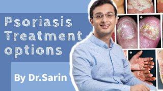 Psoriasis Treatment | Psoriasis Skin Disease | Psoriasis kya hai and best treatment | Dr. Sarin