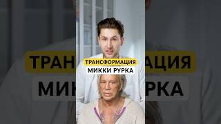 Пластика пошла не на пользу, Микки Рурк