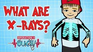 How do X-Rays Work? | Broken Bones | Operation Ouch