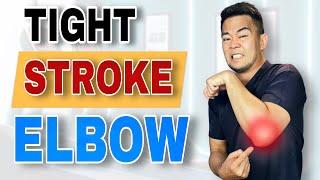 Elbow Release: Stroke Arm Therapy and Eexercises