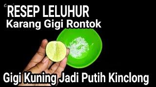 Wajib Coba !!! 2 Bahan Dapur Ini Ternyata Dapat Merontokkan Karang Gigi Dalam Waktu 5 Menit