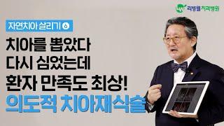 치아를 뽑았다 다시 심는다? 만족도 최상인 의도적 치아재식술이 가능한 경우와 불가능한 경우