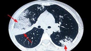 What is your diagnose? Radiology Buzz