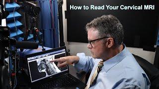 How to Read Your Cervical MRI (Part I of 2): A Deep Dive Into How to Read Your Cervical MRI.