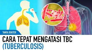 Penanganan TBC Yang Tepat Dan Cepat Berdasarkan Saran Dokter | Kata Dokter