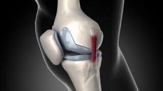 Anatomy of knee pain