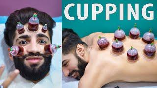 Wet Cupping Therapy \ Hijama for Skin Care | My First Hijama Cupping