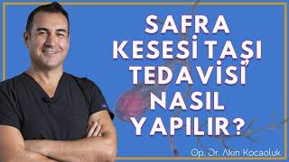 Safra Kesesi taşı nedir? Belirtileri nelerdir? Tedavisi nasıl yapılır?