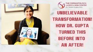 Dr. Gupta's Revolutionary Techniques for an Amazing Transformation! #beforeandaftertransformation