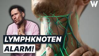 Unbekannte Knubbel: Gefährlich von harmlos unterscheiden! Wichtigsten Fakten zu großen Lymphknoten