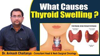 What Causes Thyroid Swelling? | Thyroid Nodules and GoiterTreatments | Kaizen Oncology Network