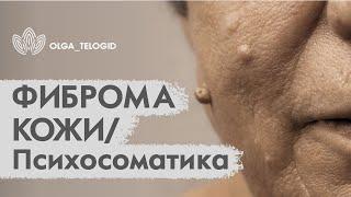 ФИБРОМА КОЖИ/ Психосоматика/ Телесный психолог, регрессолог Ольга Фахрутдинова