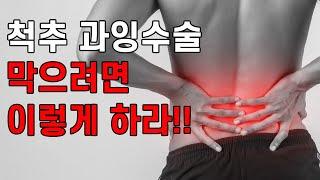 척추 과잉수술  막으려면 이렇게 하라!!!