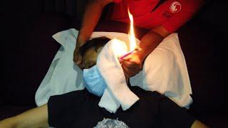 Fire EAR CLEANING & MASSAGE with Burning Candle