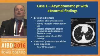 Extraintestinal Manifestations in Pediatric IBD: Pulmonary complications of IBD or treatment