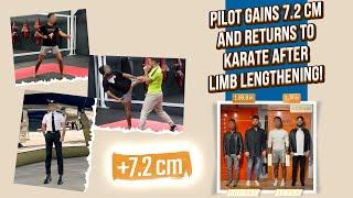 PILOT GAINS 7.2 CM AND RETURNS TO KARATE AFTER LIMB LENGTHENING!