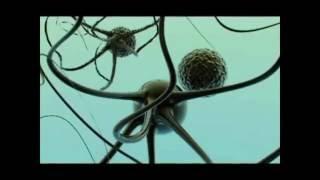 Cognition in MS in Lanzarote - Video Abstract 105805
