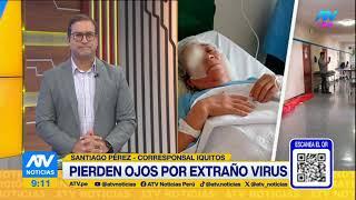 Denuncian negligencia en el hospital Rebagliati: Extirparon ojos a pacientes por supuesto virus