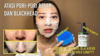 Cara hilangkan komedo paling manjur | Foreo Luna Mini 2 | Bye Bye Blackhead Review