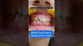 Broken Front Tooth? Fix it NOW! Dr. Srishti Bhatia #teeth #dentist
