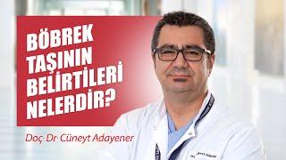 Böbrek taşının belirtileri nedir? - Doç Dr. Cüneyt Adayener