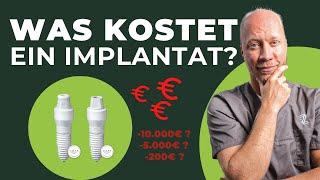 Wie teuer ist ein Zahnimplantat: Infos über Kosten