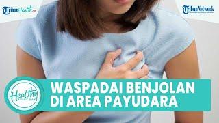 Waspadai Benjolan di Payudara Bisa Jadi Penyakit Serius, Begini Cara Atasi dengan Obat Tradisonal