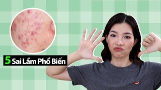 5 SAI LẦM PHỔ BIẾN TRỊ MỤN VÀ NGỪA MỤN