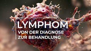 Erforschung der Behandlungsmöglichkeiten für Lymphome