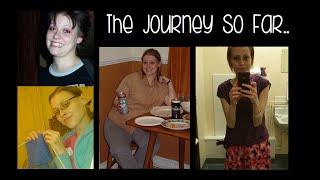 The Journey So Far | My IBD & Ostomy Story | Thaila Skye