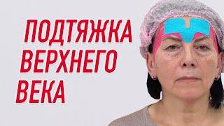  ПОДТЯЖКА ВЕРХНЕГО ВЕКА | Валентин Гайт | Учебный центр BBALANCE