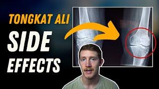 Tongkat Ali | Side Effects To Look Out For