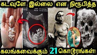 கண்ணீர்வரவைக்கும் 21 மனிதர்கள்! | Real People With Extremely Weird Diseases | Tamil Ultimate