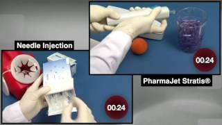 Workflow of the PharmaJet Stratis® Pre-filled Syringe (PFS) vs. Traditional Needle PFS