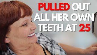 Went From Traditional Dentures to Dental Implants