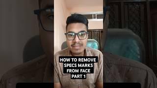 How to remove specs marks on face | specs marks on nose | How to get rid of specs marks on nose #eye