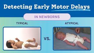 Newborn Typical & Atypical Development | Baby Motor Development Exam