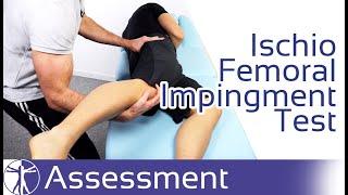 Ischiofemoral Impingement Test | Ischiofemoral Impingement Syndrome (IFI)