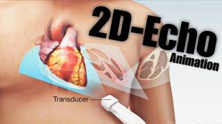 Echocardiography || 2D-Echo of heart || Animation • Daily Cardiology